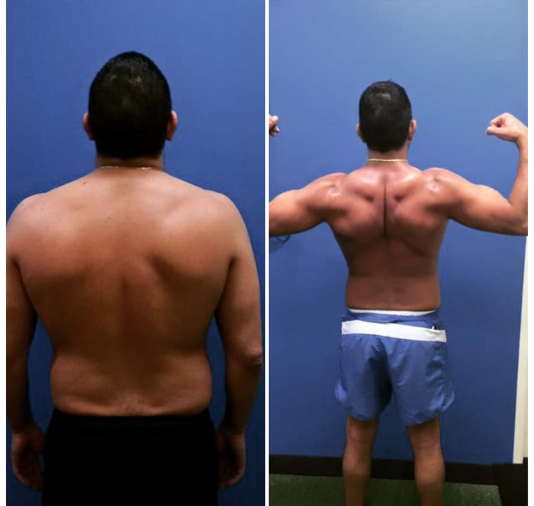Muscle Tone 3 Before And After